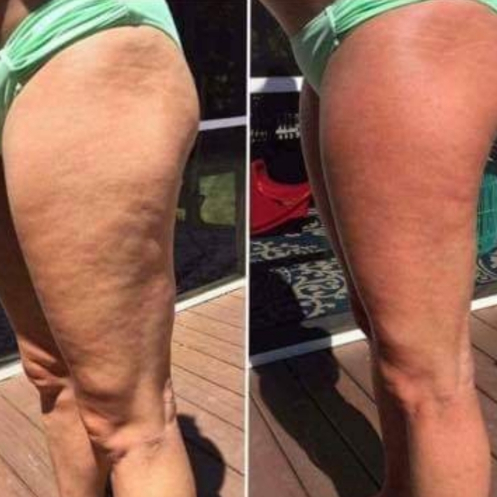 Anti-cellulite Firming Cream Body Boost - Picture 5 of 10